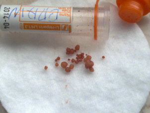 Irish Terrier Boru Cystinsteine Irish Terrier Cystinurie Steine im Harn Boru