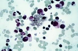 cystinsteine-grafik-Kopie-e1587988540676